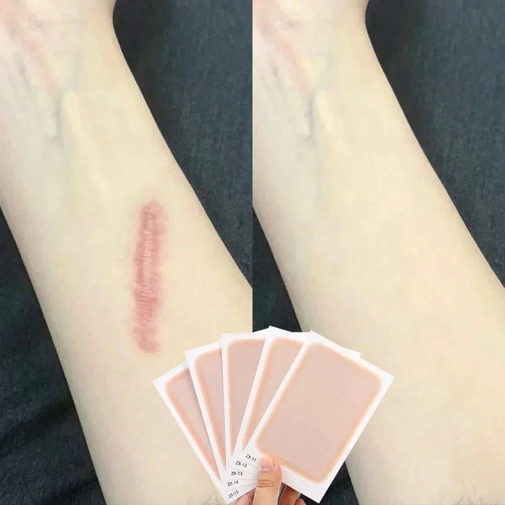 5Pcs Full Cover Concealer Tattoo Waterproof Scar Acne Cover Up Stickers Body Arm Temporary Flaw Hide Tapes Cover-up Patches